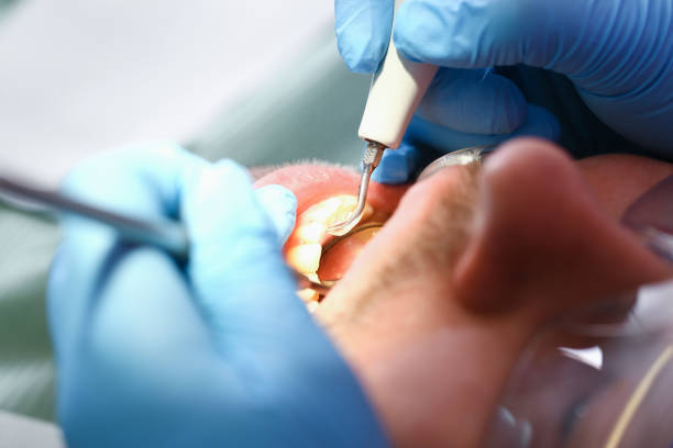 Best Broken or Cracked Tooth Emergency Dentist in Quitman, TX