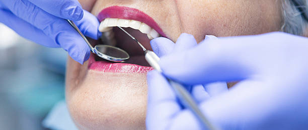 Best Emergency Root Canal Treatment in Quitman, TX
